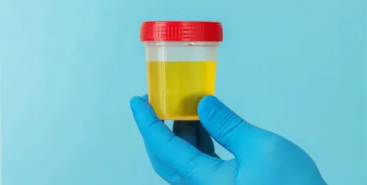 Kolor moczu a problemy zdrowotne